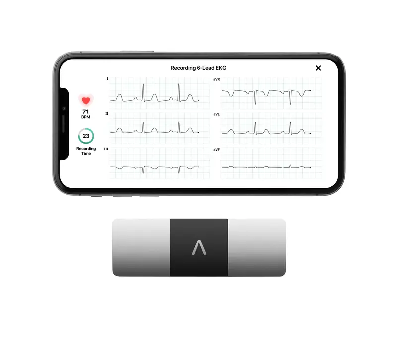 KardiaMobile 6L Personal EKG Monitor – FDA-Cleared, Compatible with Most Smartphones