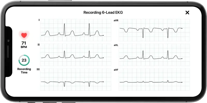 KardiaMobile 6L Personal EKG Monitor – FDA-Cleared, Compatible with Most Smartphones