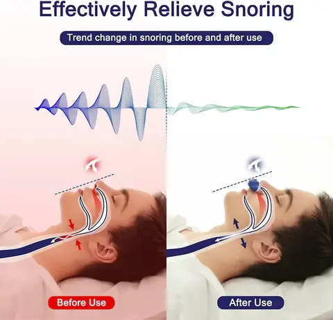 Micro CPAP Device – Portable Sleep Apnea Therapy Machine for Travel
